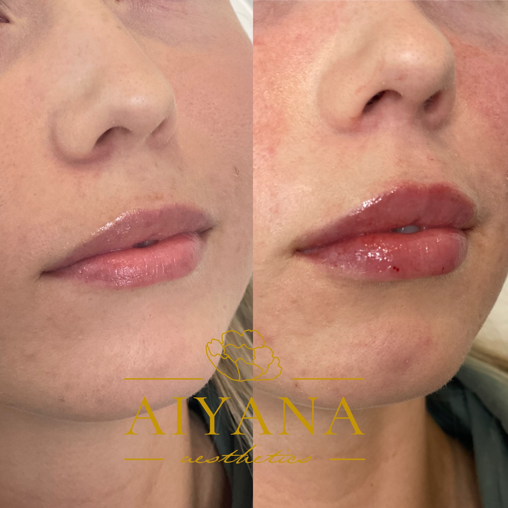 Lips-1.23.jpg
