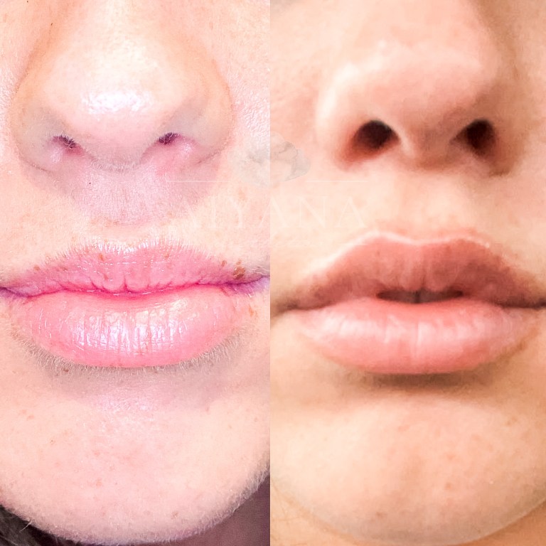 T-C-lipflip-1.jpg