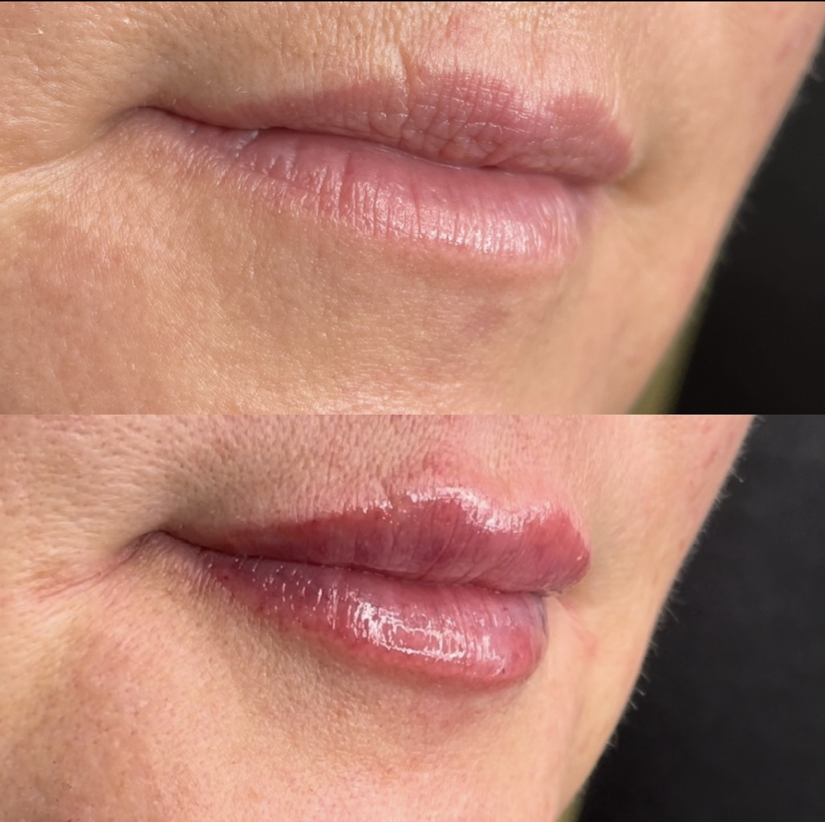 lips-e1747424175558.png