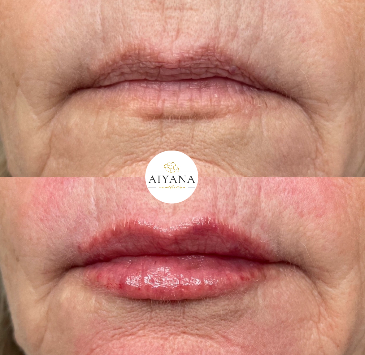 lips.jpg
